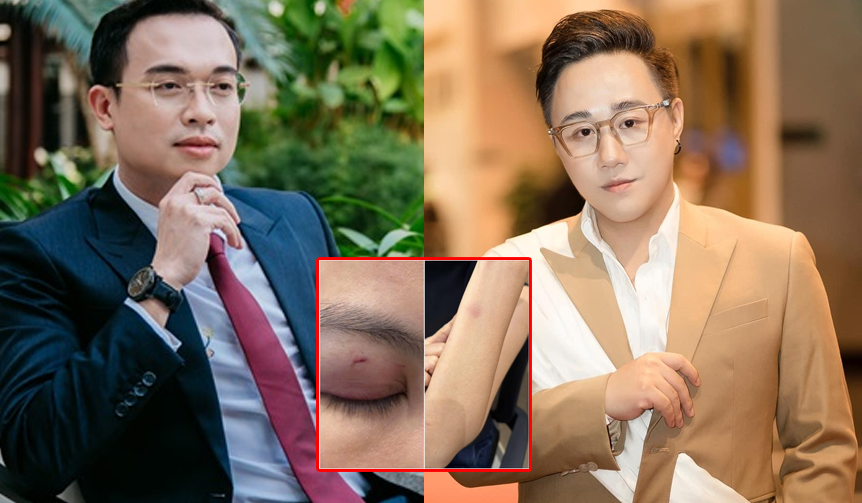 Rõ danh tính người đàn ông tố ca sĩ Trung Quân Idol hành hung vợ mình: Là bác sĩ có tên tuổi trong giới thẩm mỹ, vợ anh cũng không kém cạnh